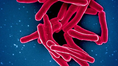 Tuberculosis Bacteria's Unconventional Growth: Tips for Targeted Therapy