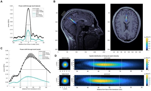 Enhance Mindfulness with Ultrasound: The Ultimate Solution for Mental Health