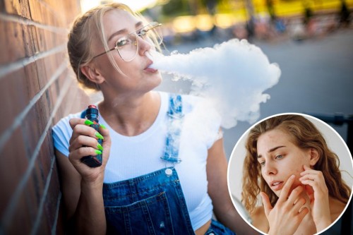 Vaping and Skin Ageing: The Impact on Generation Z