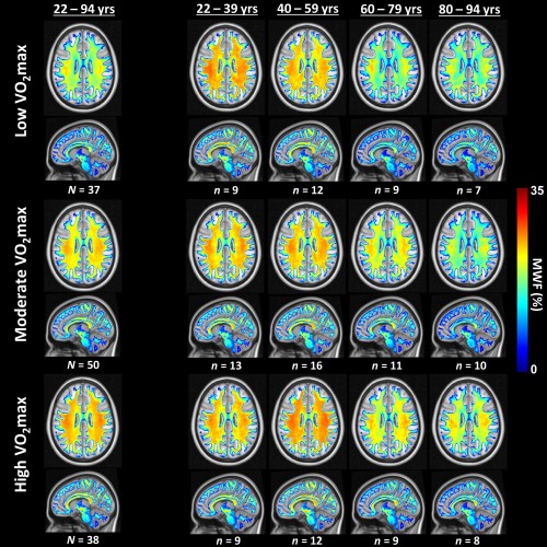 Cycling: The Solution to Boost Brain Health and Wellness