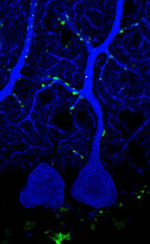 Discover the Solution: Neuroscience Research on Synaptic Plasticity in the Cerebellum